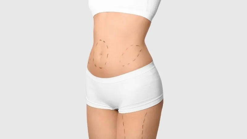 Annelik Estetiği Zor mudur? - Antalya