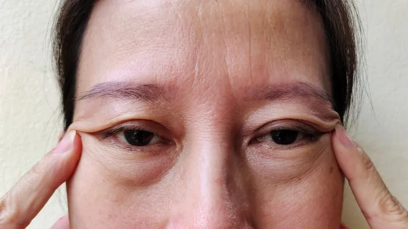 Göz Altı Torbası Nasıl Gider? Antalya Göz Altı Torbası Nasıl Gider? - Antalya