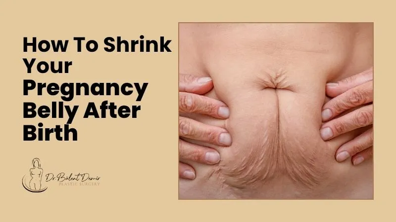 How to shrink your pregnancy belly after birth