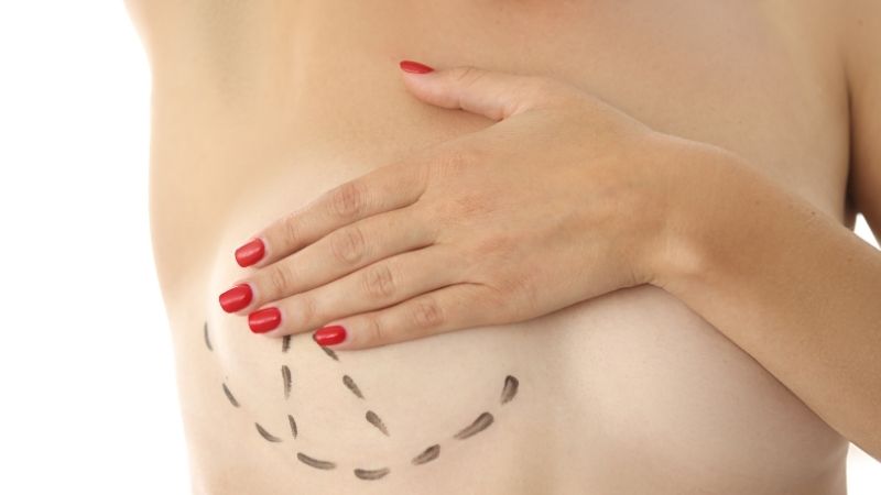 Breast lift in Turkey Antalya