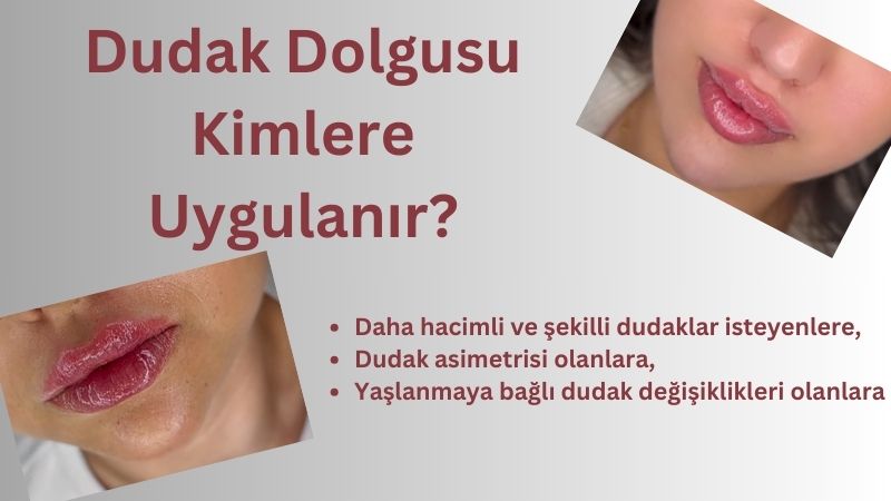 Dudak dolgusu kimlere uygulanır? Antalya