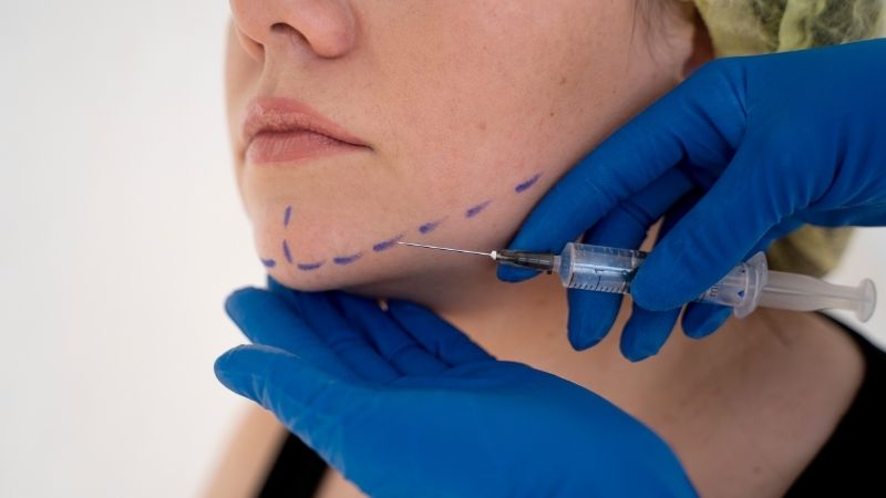 Enzimatik Liposuction Nedir? Nasıl Yapılır? Enzimatik Liposuction mı Klasik Liposuction mı? Antalya