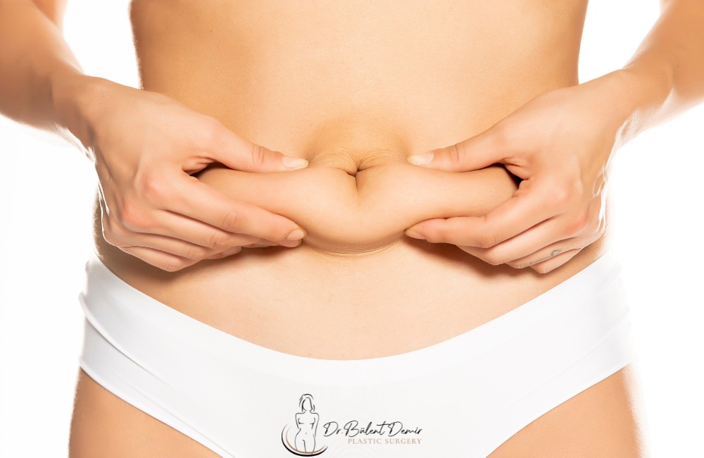 liposuction Antalya