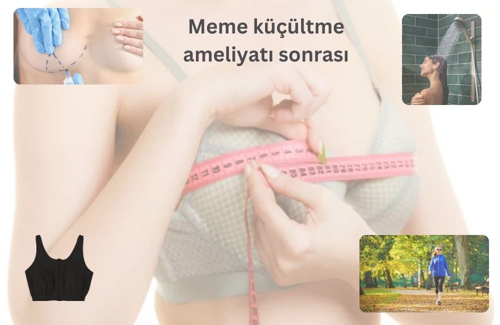 Meme Küçültme Sonrası Antalya