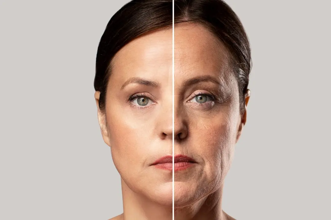 Are There Scars After Facelift Surgery? 