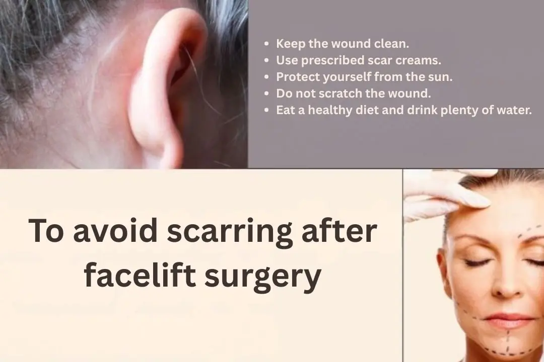 What should be done to avoid scarring after facelift surgery? What should be done to avoid scarring after facelift surgery?