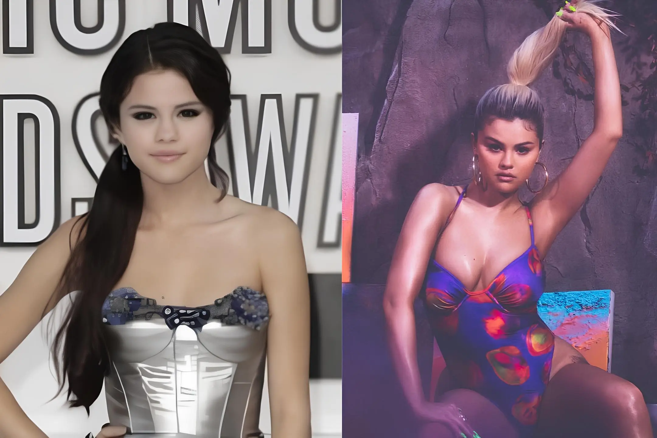 Selena Gomez breast augmentation before and after Turkey Antalya