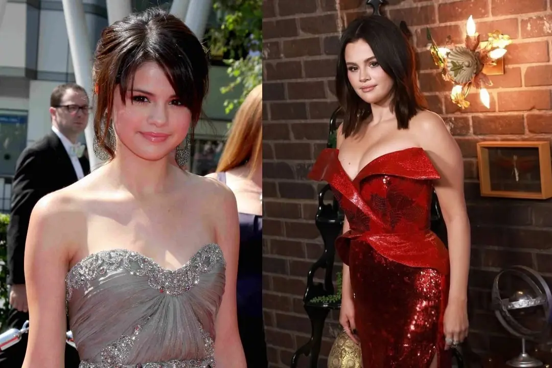 Selena Gomez breast augmentation before and after Turkey Antalya