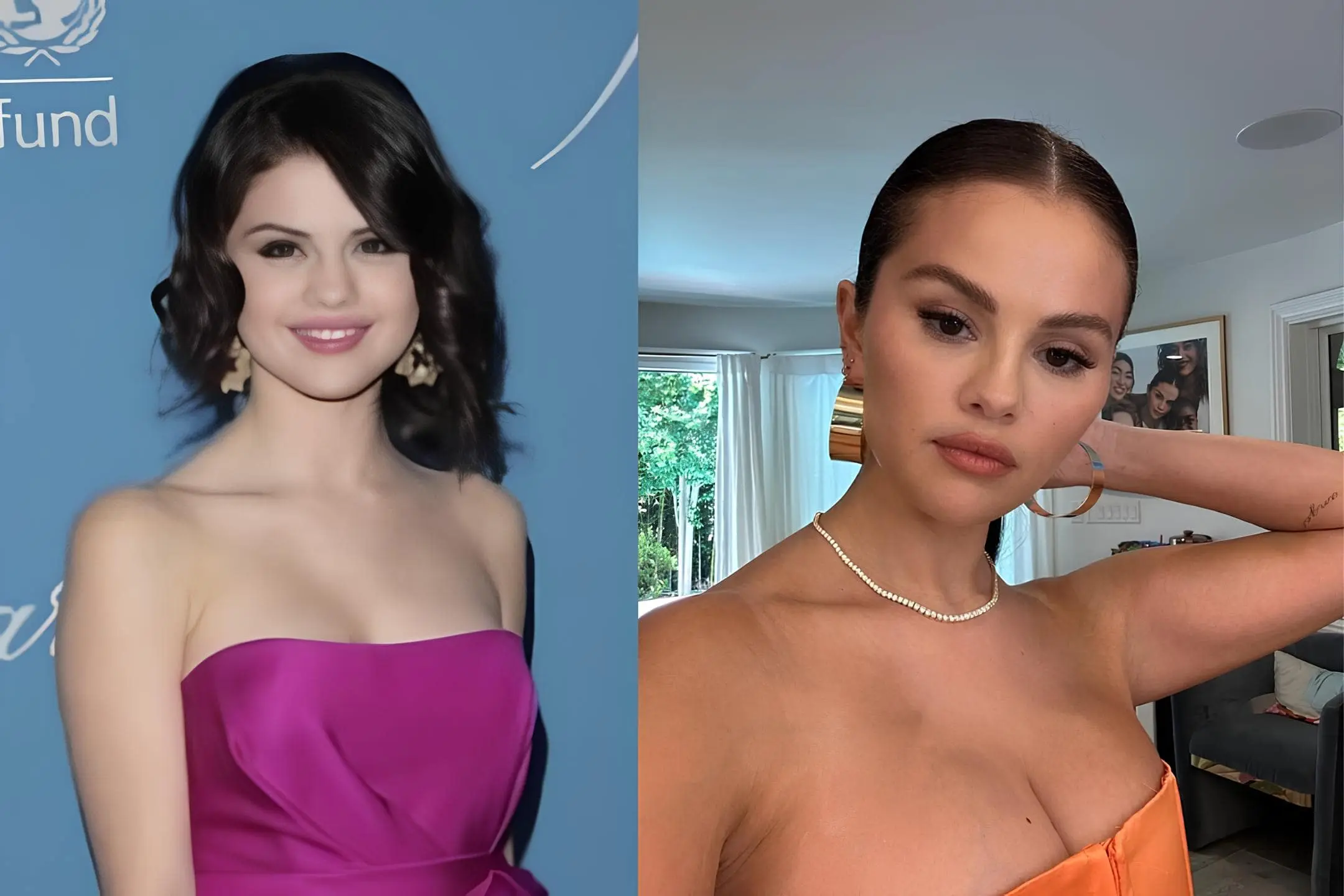 Selena Gomez breast augmentation before and after Turkey Antalya