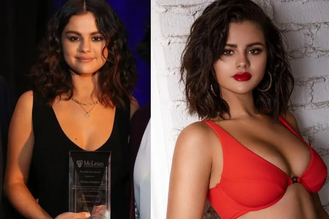 Selena Gomez breast augmentation before and after Turkey Antalya