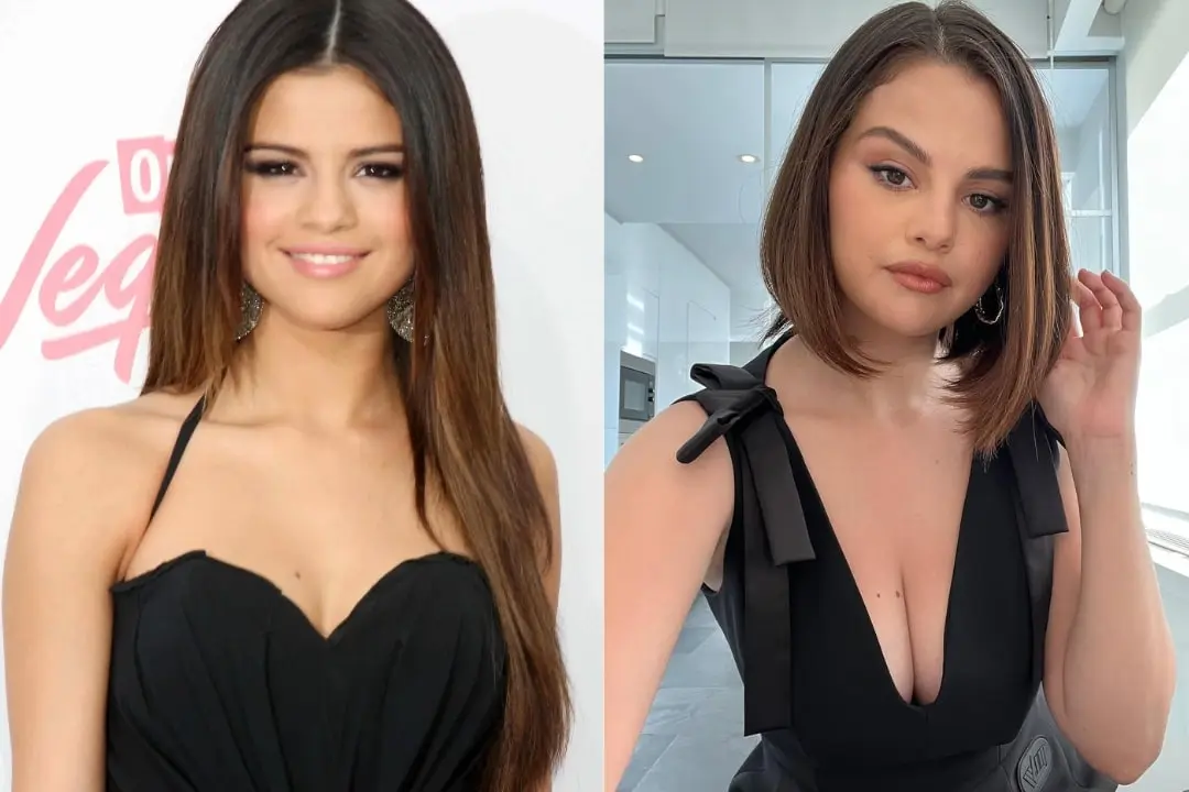 Selena Gomez breast augmentation before and after Turkey Antalya