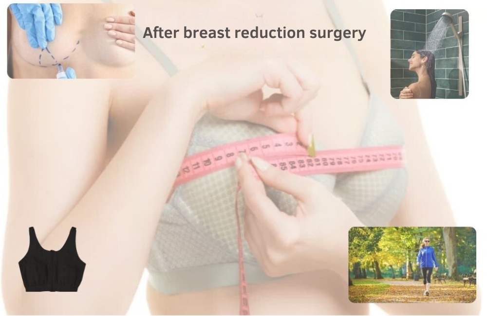 What should be considered after breast reduction surgery? Turkey Antalya